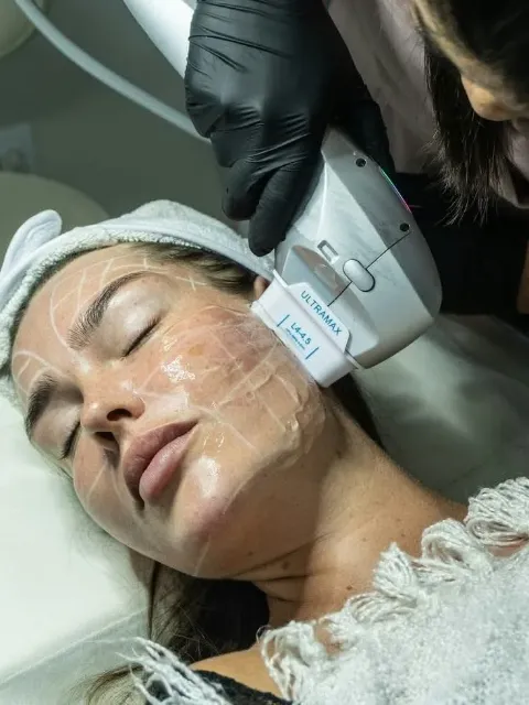Hifu lica (12d hifu) u salonu Cecacosmetics 021